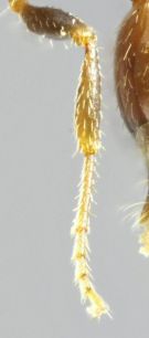 poils dressés aux tibias